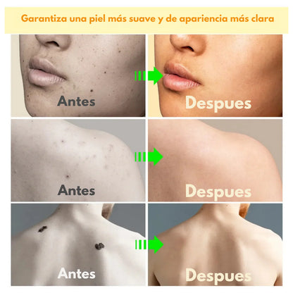 PureBee Skin Repair | Antiverrugas Natural